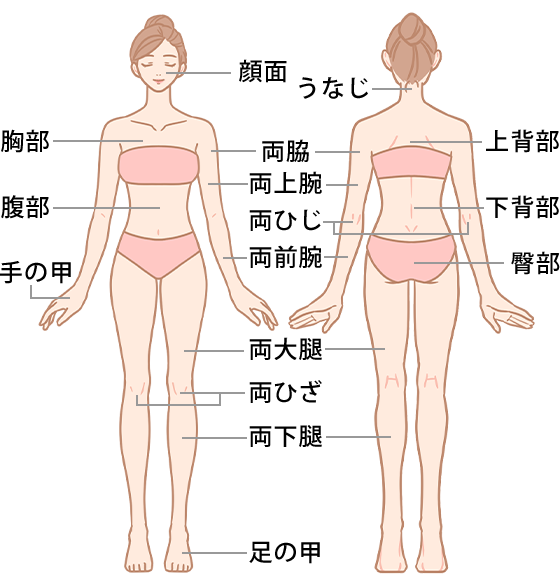 対応部位